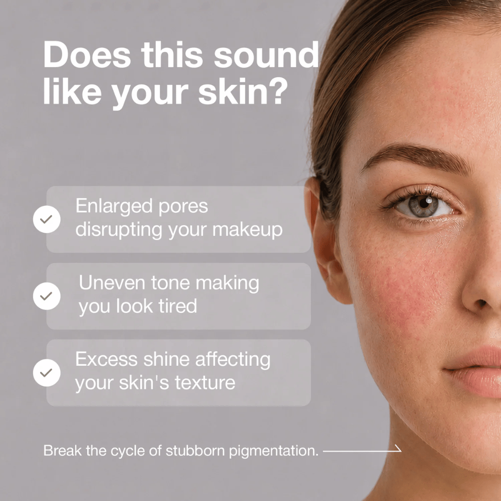 5. NINE LESS B-Boost 22% Niacinamide Serum – iho, jossa näkyviä ihohuokosia, epätasainen ihonsävy ja liiallista kiiltoa