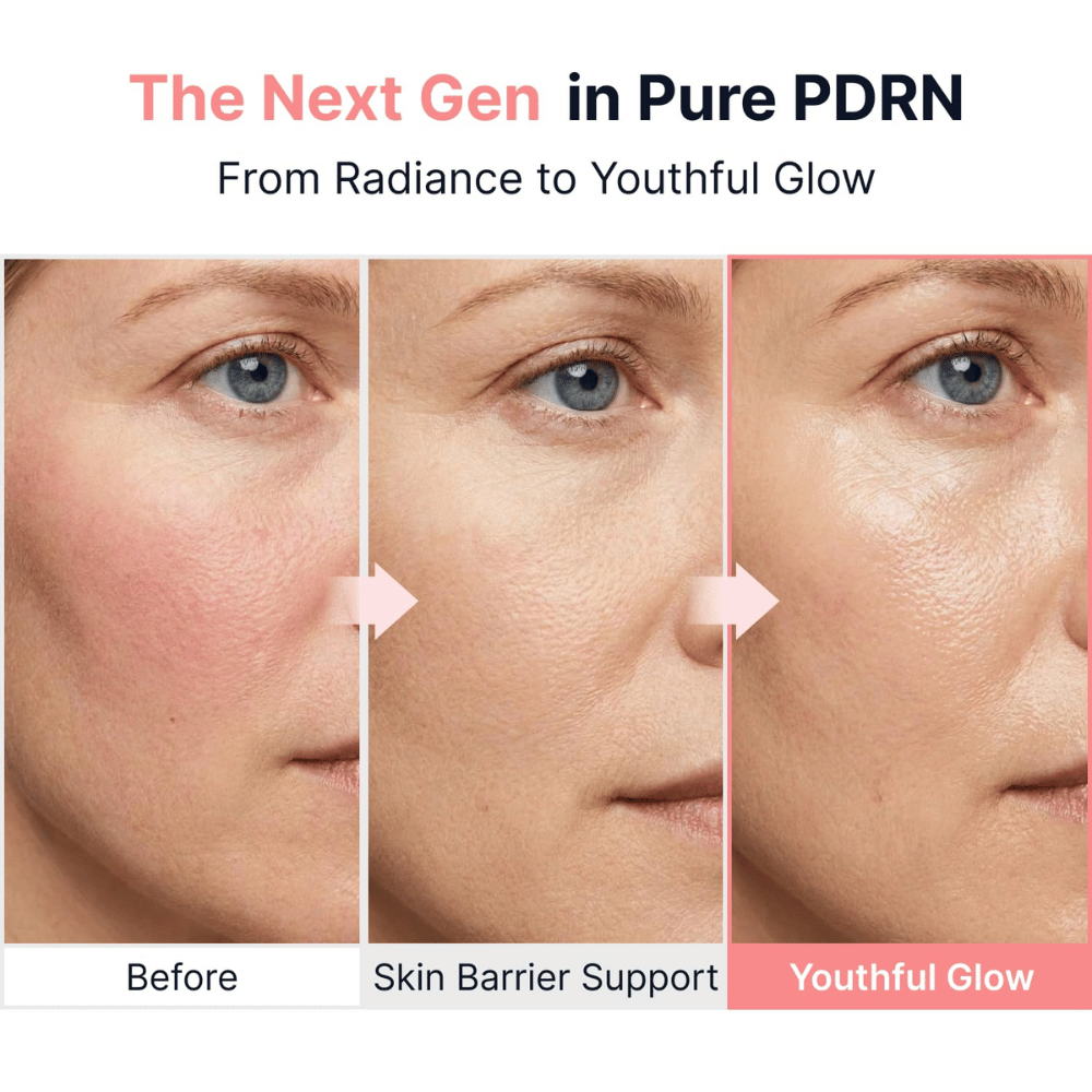 6. SUNGBOON EDITOR PDRN Pink Vitamin Glow Boosting Ampoule – vertailevat ihokuvat, jotka havainnollistavat parantunutta ihon rakennetta, ihon suojakerrosta ja hehkua